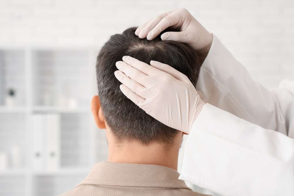 hair transplant London