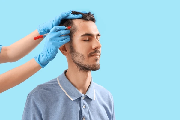 Jude Law hair transplant before and after